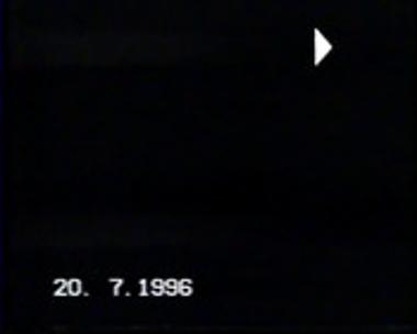 ΜΑΝΑ ΚΟΥΡΑΓΙΟ