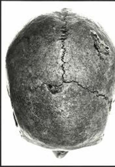 Το κρανίο με ενδείξεις βιαιότητας που βρέθηκε στον τάφο 1 της ύστερης ρωμαϊκής εποχής (τάφρος 41, άνδηρο IV).