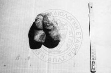 Sculpture of young man (part).