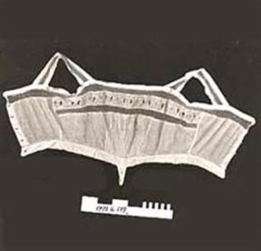 ΣΤΗΘΟΔΕΣΜΟΣ