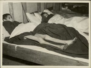 Volary, former Chechoslovakia, concentration camp, emaciated 17-uear-old girl after 30 days of death march.