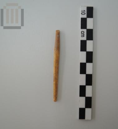 Bone fibula