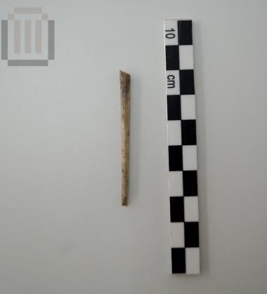 Bone fibula