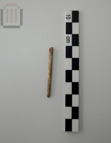 Bone fibula