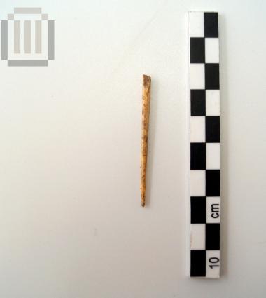 Bone fibula