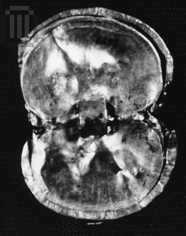 Gold pyxis lid in the shape of a figure-of-eight shield.