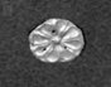 Χρυσός ρόδακας