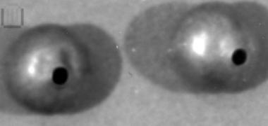 Beads (2)