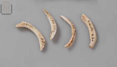 Τμήμα οστρέινου δακτυλίου (