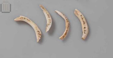 Τμήμα οστρέινου δακτυλίου (