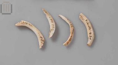 Τμήμα οστρέινου δακτυλίου (