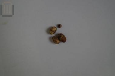 Beads